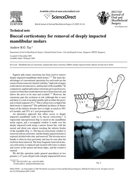 British Journal Of Oral And Maxillofacial Surgery 45 1 83 84 Buccal