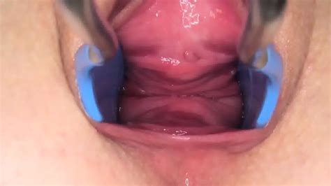 Gyno Dildo And Hard Vagina Opening Eporner