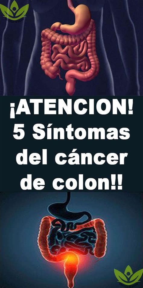 Cancer De Colon Sintomas Comunes