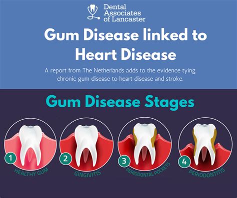 Dental News Gum Disease Linked To Heart Disease Dental Associates Of