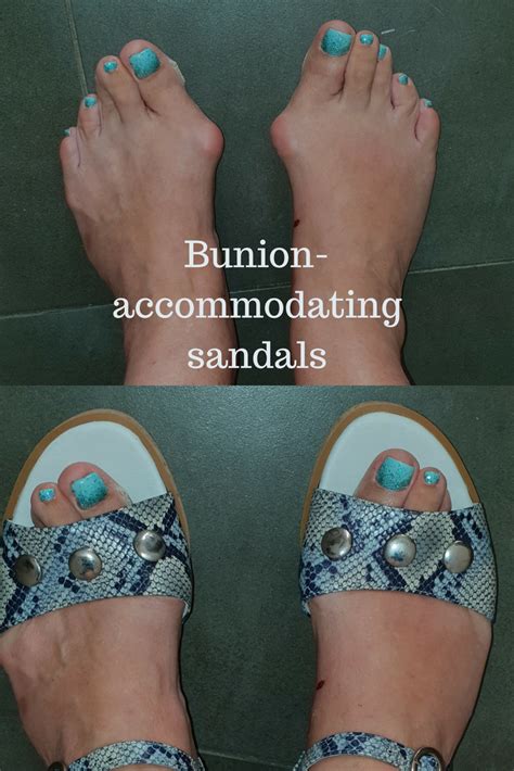 Shop Now Bunion Shoes Wide Width Sandals Comfortable Shoes