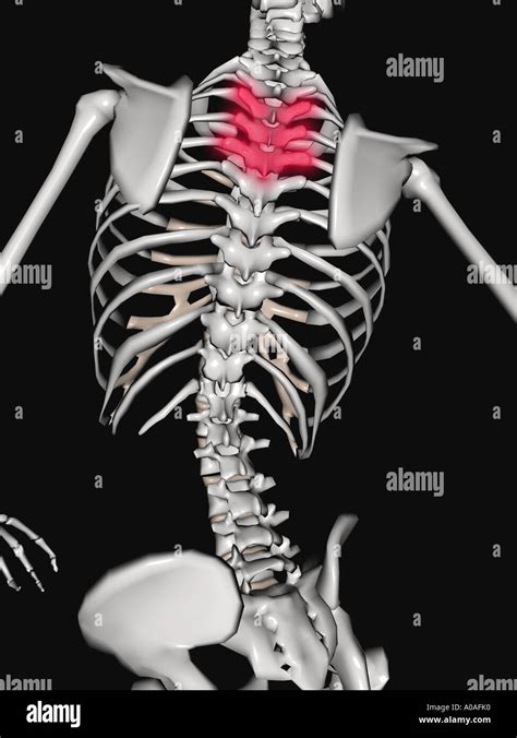 Anatomy Of Right Side Of Back Of Rib Cage Upper Back Pain The 14 Best