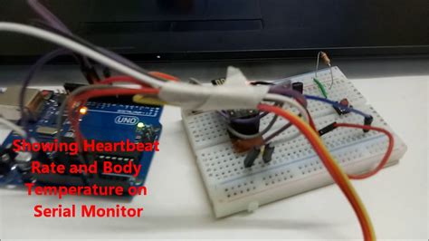 Iot Based Patient Monitoring System Using Esp And Arduino Youtube