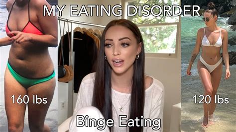 My Eating Disorder Story Binge Eating Cassie Bain Youtube