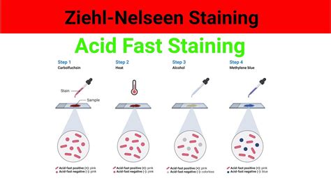 Ziehl Neelsen Stain Acid Fast Staining Test Acid Fast Staining Test Animation YouTube