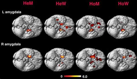 Scientists Link Brain Symmetry Sexual Orientation Wired
