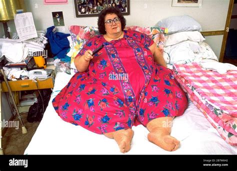 Killeen Texas USA 1993 Morbidly Obese Woman Weighing 600 Lbs