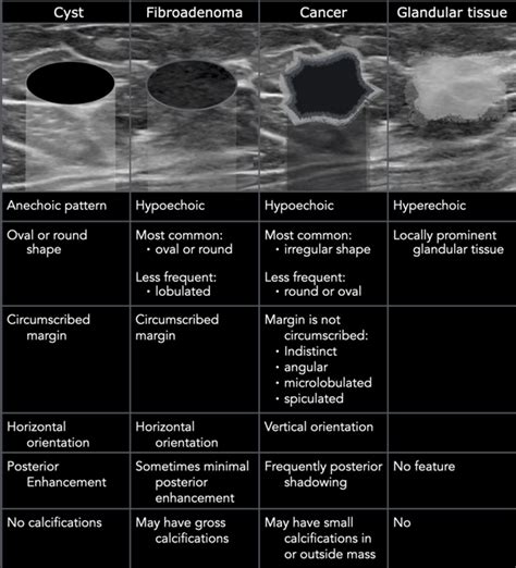 What Does Breast Cancer Look Like On An Ultrasound
