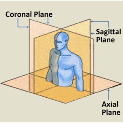 Axial Coronal Sagittal Planes Ipf Radiology Rounds