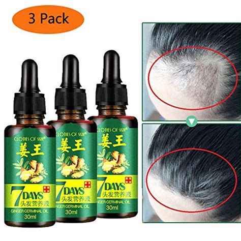 Top 10 Hair Growth Serum For Women Of 2019 Best Reviews Guide