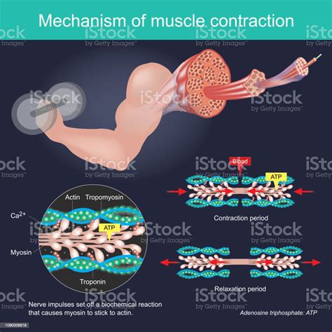 생 화 확 적인 반응에 말라 붙어 Myosin 되도록 설정 하는 신경 충 동으로 인해 근육 수축 인체 Infographic입니다