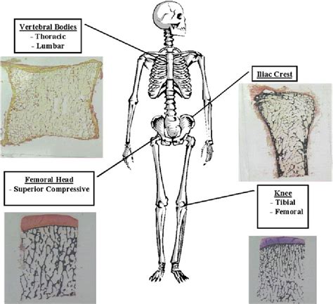 Figure 6 From Characterisation Of Trabecular Bone Structure Semantic