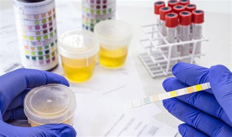 Study Suggests E Coli In Meat Could Be Causing Urinary Tract Infections
