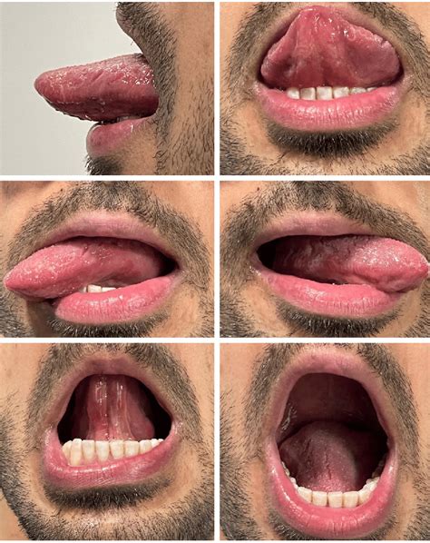 The Different Movements Of The Tongue Are Demonstrated Including