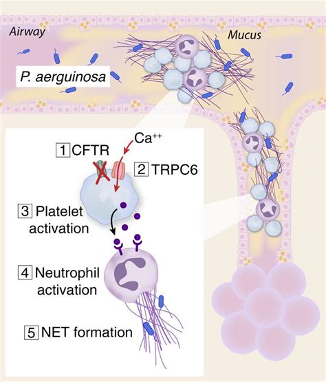 Mutations of the cftr gene affecting chloride ion. JCI - Cystic fibrosis transmembrane conductance regulator ...