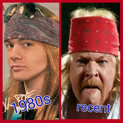 Axl Rose Then And Now Eye Opening Photos