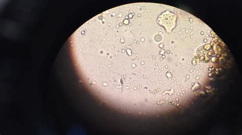 Bacterias En Microscopio Youtube