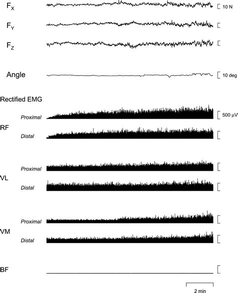 Alternate Muscle Activity Observed Between Knee Extensor Synergists During Low Level Sustained