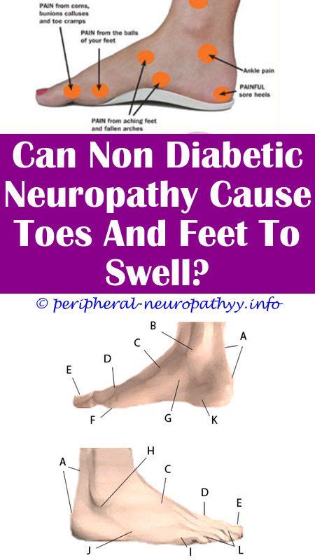 Non Diabetic Neuropathy In The Feet Diabeteswalls 18620 Hot Sex Picture