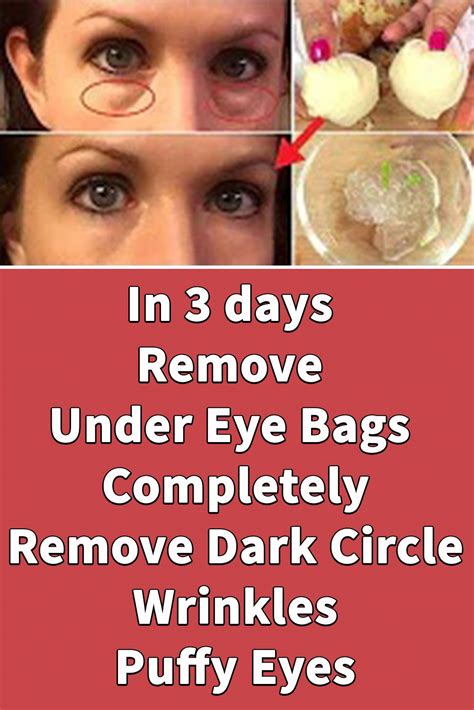 In 3 Days Remove Under Eye Bags Completely Remove Dark Circle