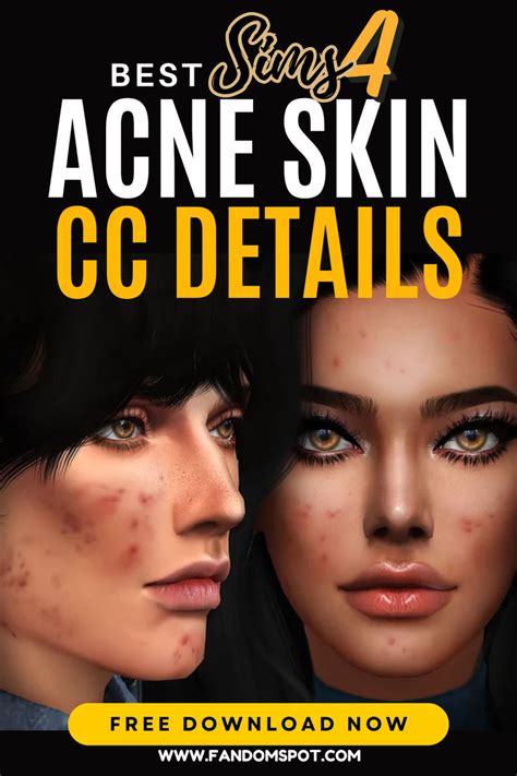 Two Women With Acne Skin On Their Faces And The Text Best Skin For Acne
