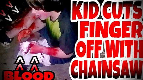 Kid Cuts His Finger Off With Chainsaw Prank Youtube
