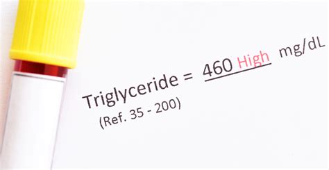 Triglyceridehdl Cholesterol Ratio And Cta Risk Score Predict Heart