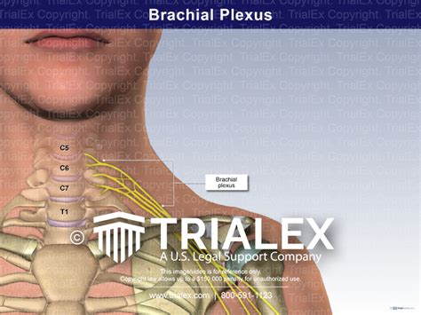 Brachial Plexus Trial Exhibits Inc