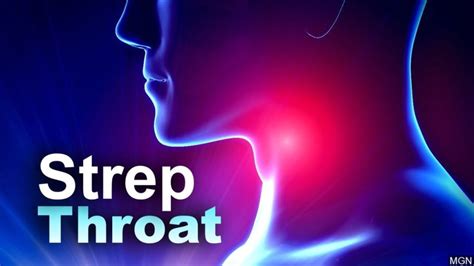 Symptoms Of Strep Throat And Treatment Ostomy Lifestyle