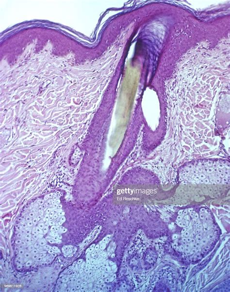 Microscopic Anatomy Of The Skin Hair Follicle And Sebaceous Glands 25x