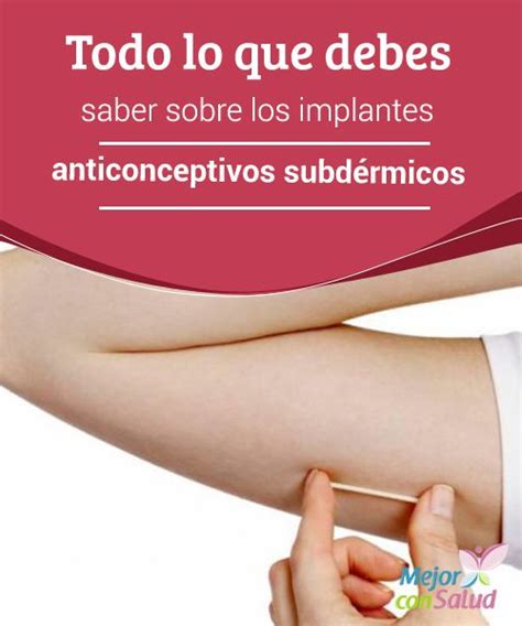 A Woman S Arm With The Words Todo Que Debes Saber Sob Los Implant