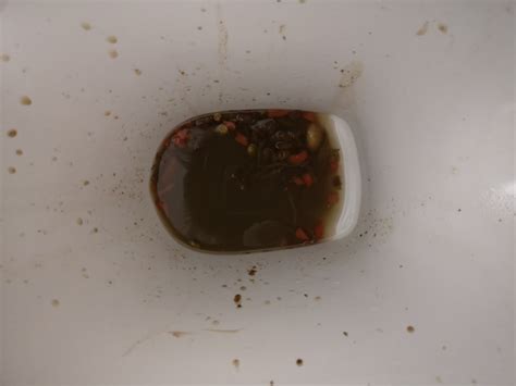 Warning Gross Poop Pic What Is Wrong With My Bowels Mumsnet