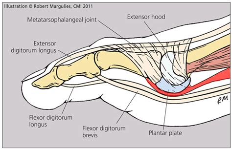 What is flexor tendon injuries? Flexor Hallucis Longus Tendon Pain: Is Surgery the Answer? - Regenexx Blog