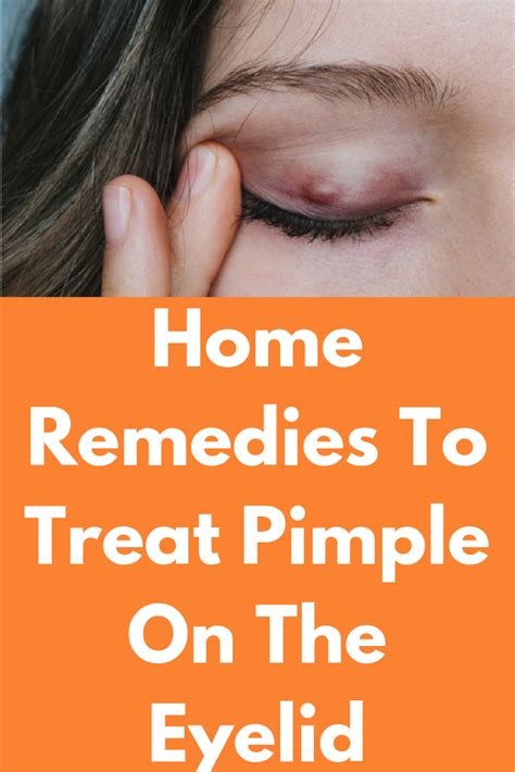 Home Remedies To Treat Pimple On The Eyelid A Pimple Is A Very Common