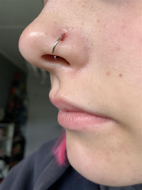 i got my nose pierced 3 week ago but it still bleeds what should i do r piercing