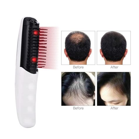 Battery Operated Massage Comb Electric Infrared Vibrating Scalp Massager Promote Hair Growth