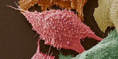 What do cancer cells eat? | eLife Science Digests | eLife