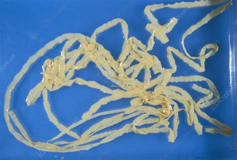 Beef Tapeworm Stock Image C0075505 Science Photo Library