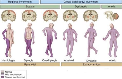 Techniques To Inhibit Spasticity With Physiotherapy Treatments Mobile Physiotherapy Clinic