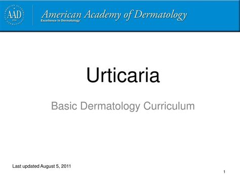 Ppt Urticaria Powerpoint Presentation Free Download Id6171058