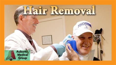 Let The Hair Out Ear Foreign Body Removal Auburn Medical Group