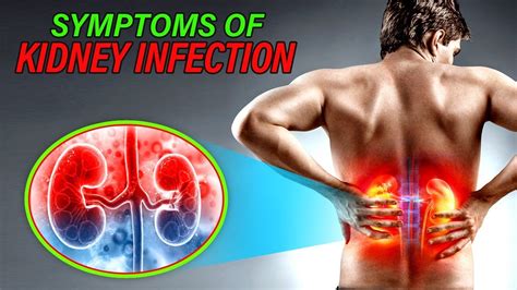 Symptoms Of Kidney Infection Youtube