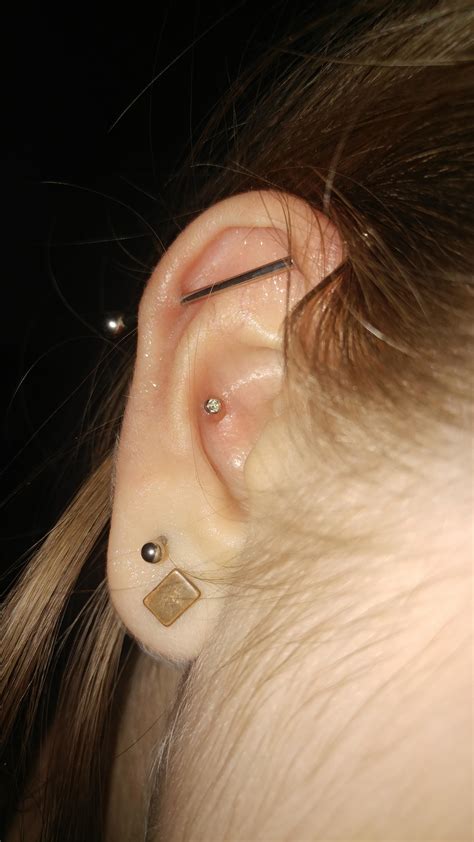 Does My Conch Have A Keloid Forming Or Just An Irritation Bump Rpiercing