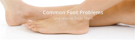Foot Problems List Of Common Foot Ailments