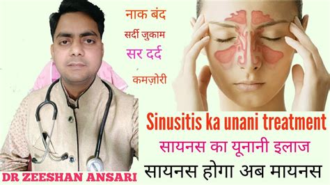 Sinusitis Ka Unani Ilajसर्दीपुराना नज़लाज़ुकाम नाक बंदसर दर्द