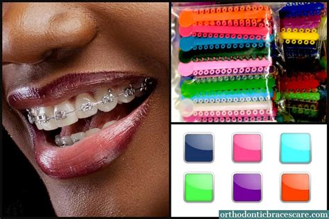 Braces Color Combinations For Girls