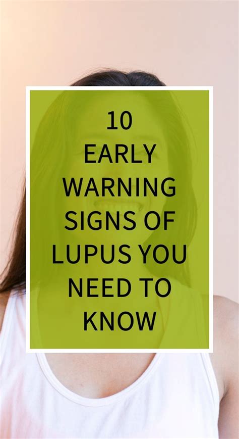 10 Early Warning Signs Of Lupus You Need To Know Natural Cough