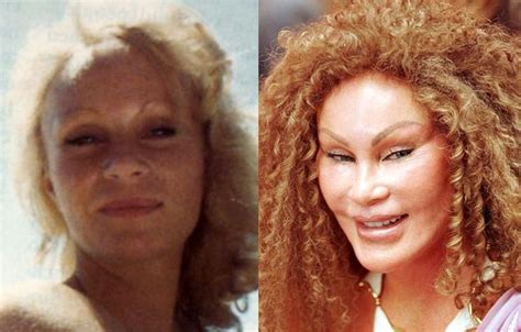 Jocelyn Wildenstein Before And After Plastic Surgery 01 Celebrity