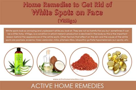 How To Get Rid Of White Spots On Face Active Home Remedies