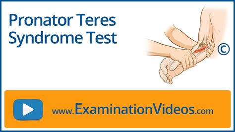 Pronator Teres Syndrome Test Youtube